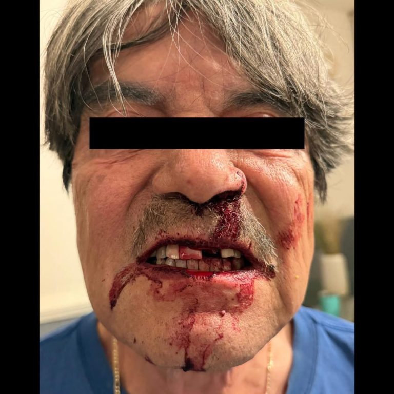 Golpean brutalmente al científico Octavio Paredes