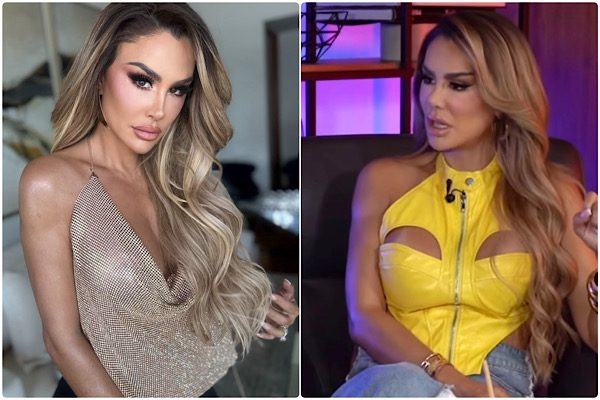 NINEL CONDE RESPONDE A CRÍTICAS POR SU ROSTRO Y NO DESCARTA MÁS CIRUGÍAS