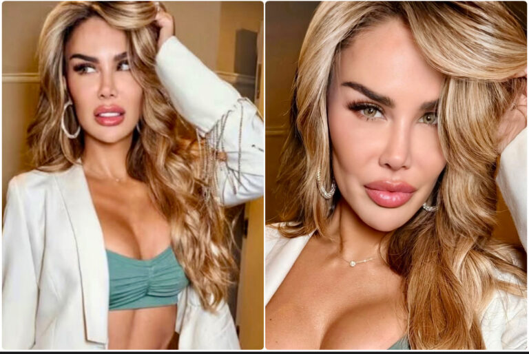 NINEL CONDE SE SOMETE A RIESGOSA CIRUGÍA PARA CAMBIAR EL COLOR DE SUS OJOS