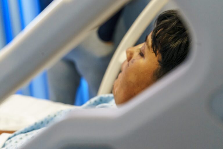 Llama la Secretaría de Salud a prevenir quemaduras por accidentes