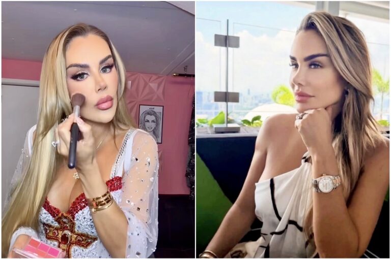 ¡NINEL CONDE NO SE DETIENE! ANUNCIA NUEVA CIRUGÍA ESTÉTICA