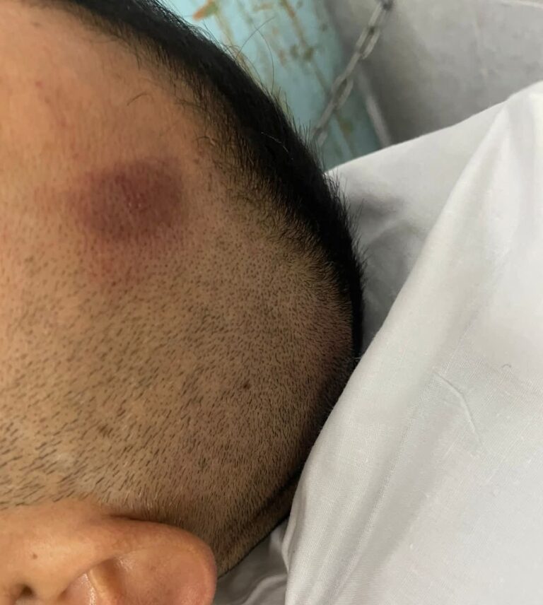 Abre Fiscalía investigación por agresión a periodista en zona Celaya–Juventino Rosas