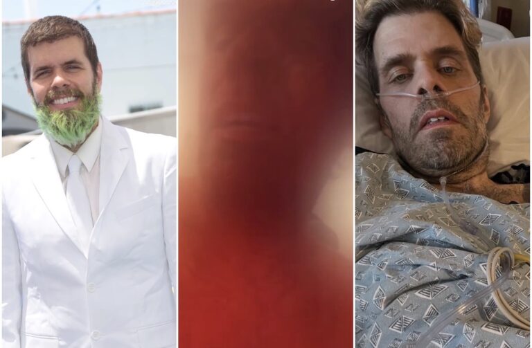 PÉREZ HILTON SUFRE CRISIS DURANTE TRANSMISIÓN EN TIKTOK Y TERMINA HOSPITALIZADO