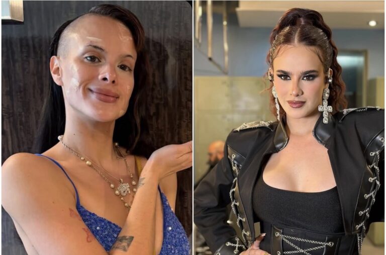 ¡GALA MONTES SE HACE RETOQUE EN EL ROSTRO!