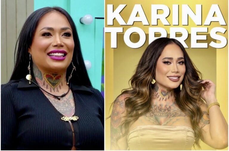 ¡KARINA TORRES ENFRENTA NUEVOS PROBLEMAS DE SALUD POR BIOPOLÍMEROS!